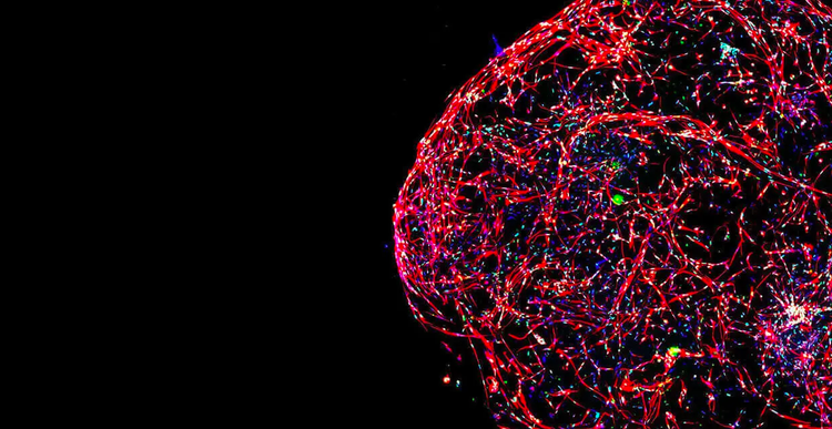 3D Cell Models Drug Discovery