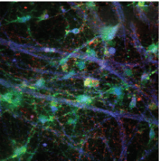 High-Intensity Lasers Image