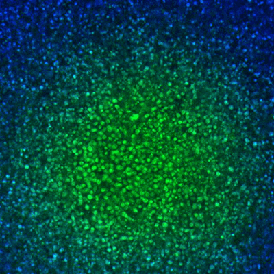 Deep Tissue Penetrating with Confocal Disk