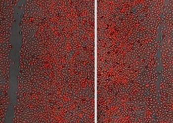 Cell Migration Assays