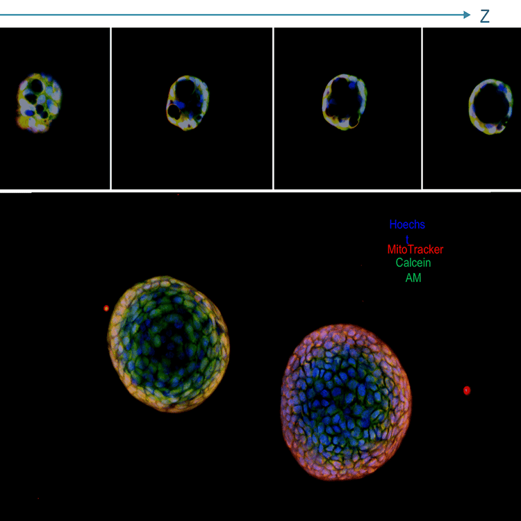 Lung organoids,projection image and a panel with Z stack; live stained with Hoechstblue,nuclei),MitoTracker(red,mitochondria),and Calcein AM(green,viability dye);20x water immersion