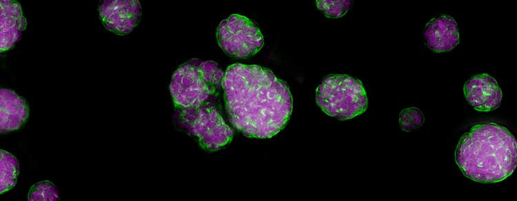 Study reveals insights into how cancer cells evade treatment