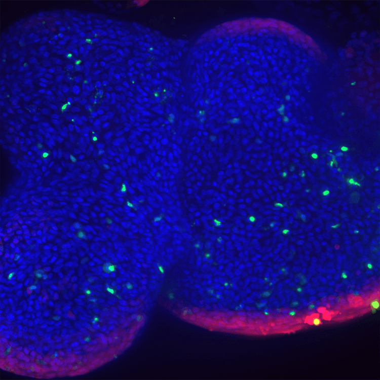 Lung organoids lung airway