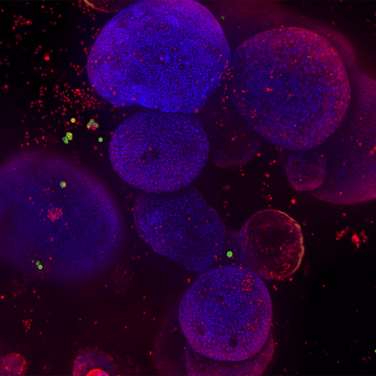 Lung organoids