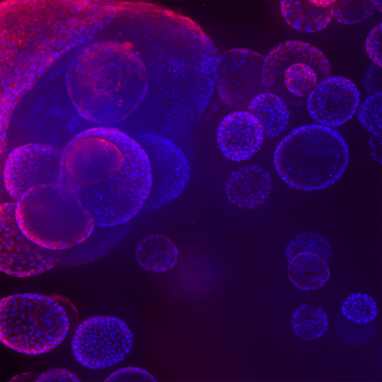 Lung organoids