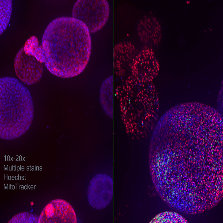 Lung organoid 10x 20x Multiple stains Hoechst MitoTracker