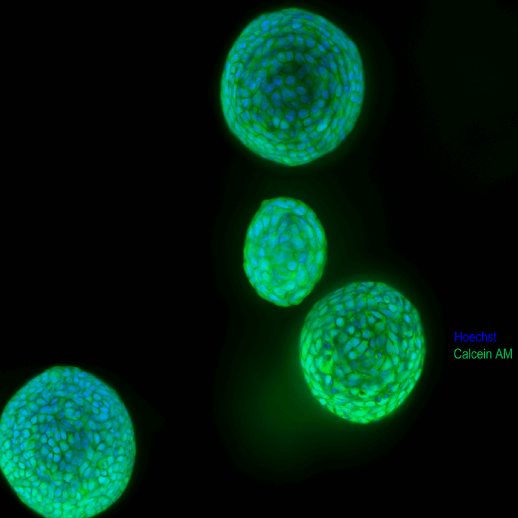 Lung organoids