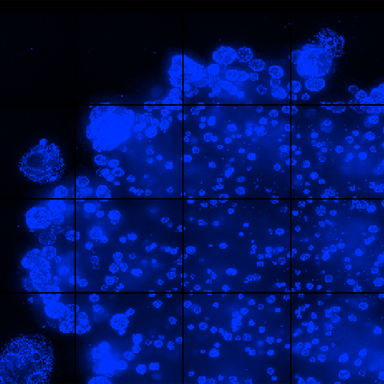 live organoids in Matrigel