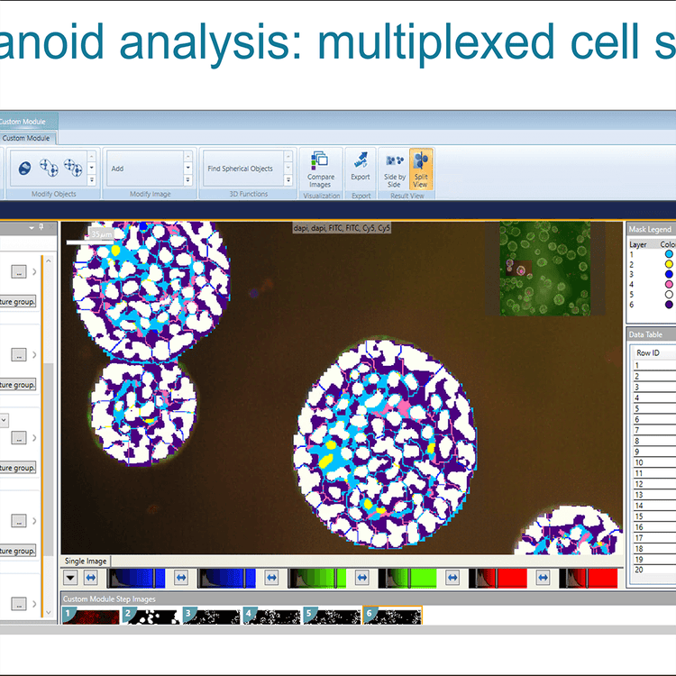 Organoid analysis multiplexed cell scoring