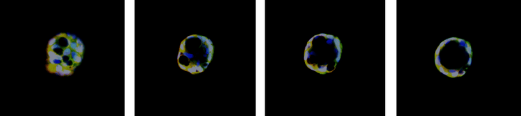 Confocal imaging and 3D image analysis of organoids