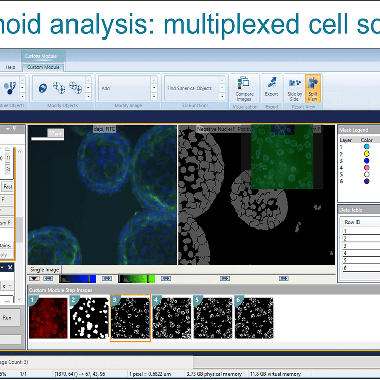 Organoid analysis multiplexed cell scoring