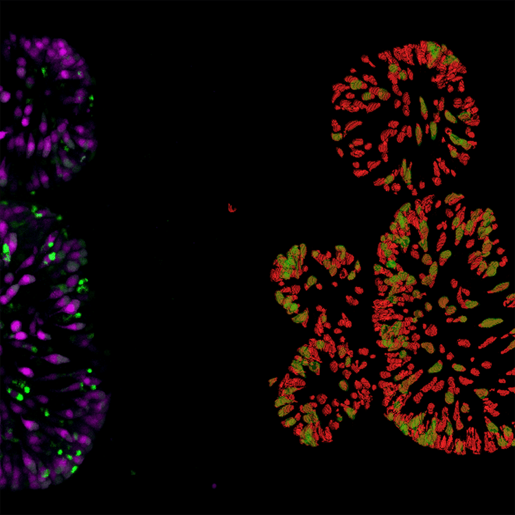 Gut organoid dTomato cells in red Detection of Double positive(mNeon) in green