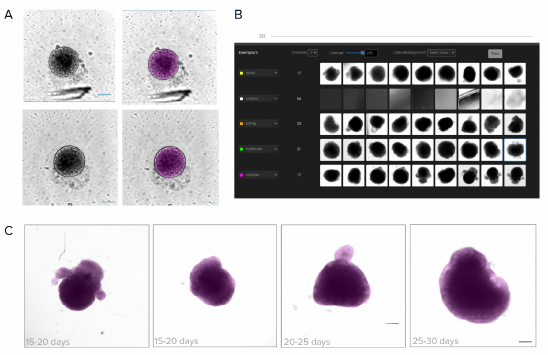 3D cerebral organoids using AI-based analysis tools