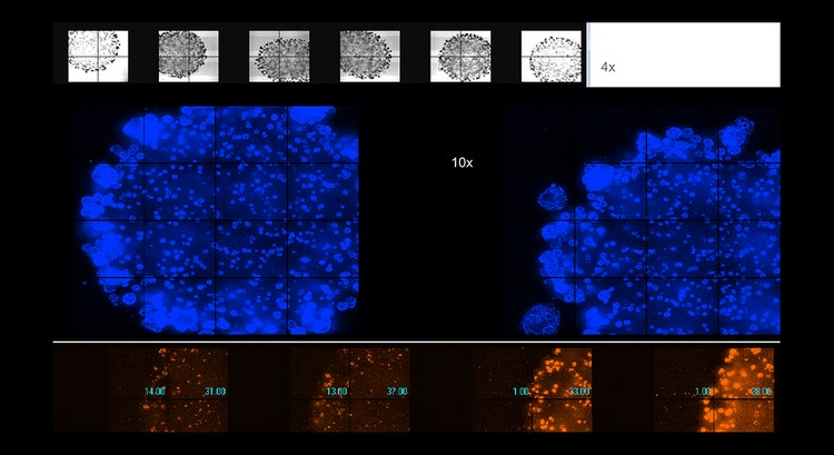 Automated imaging of live organoids in Matrigel was done using confocal option, 4x or 10x magnification