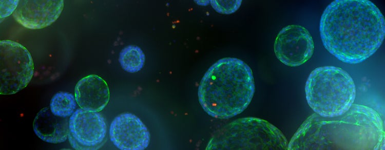 Pulmonary (Lung) Organoids