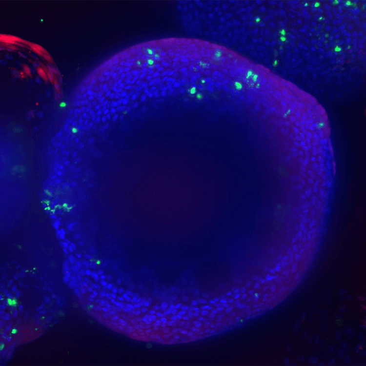 Lung organoids lung airway epithelial cells cultured in matrigel domes for 8 weeks