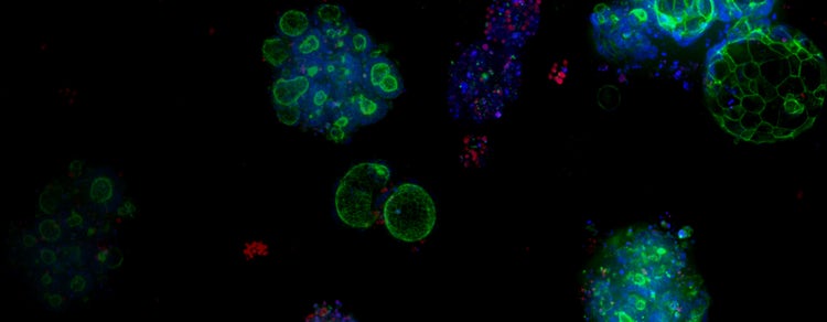 Colorectal Cancer (CRC) Organoids
