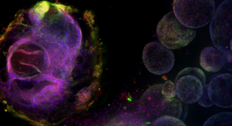 High complexity lung organoid