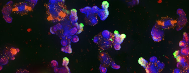 Intestinal Organoids