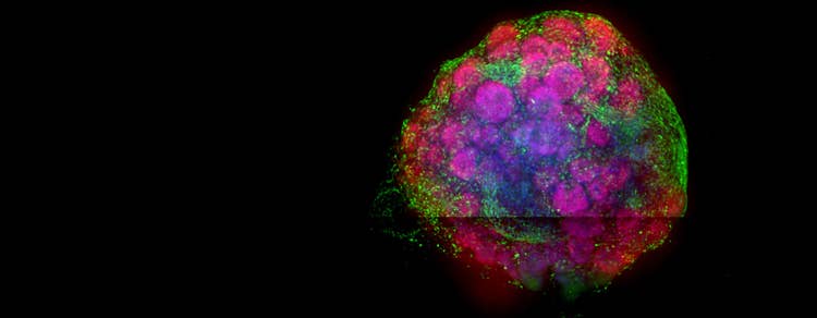 Brain Organoids