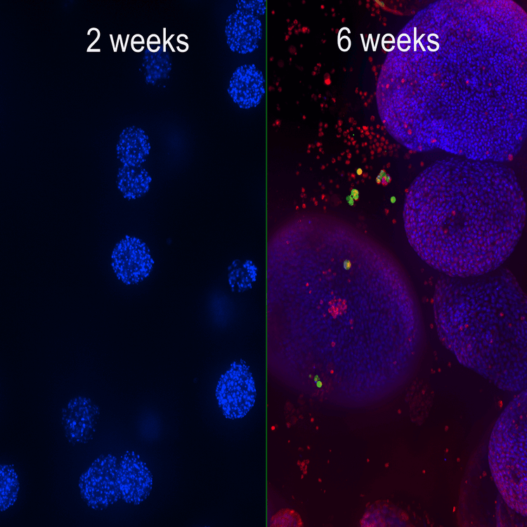 Organoid development- 2 weeks and 6 weeks