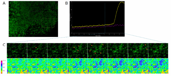 Calcium imaging of brain organoids to determine neuronal activity