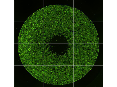 Imaging cell migration