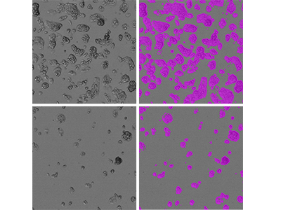 StainFree determination of % covered area