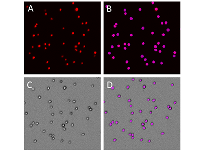 Undifferentiated THP-1 cells imaged on the MiniMax cytometer