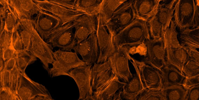 F-actin cytoskeleton, Golgi, plasma membrane Dye: Phalloidin/Alexa Fluor 568 conjugate, wheat-germ agglutinin/Alexa Fluor 555 conjugate