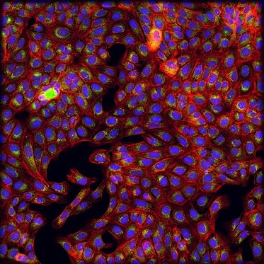 Cells treated with chloroquine