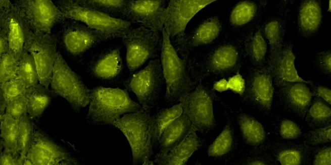 Nucleoli, cytoplasmic RNA -Dye: SYT0 14 green fluorescent nucleic acid stain