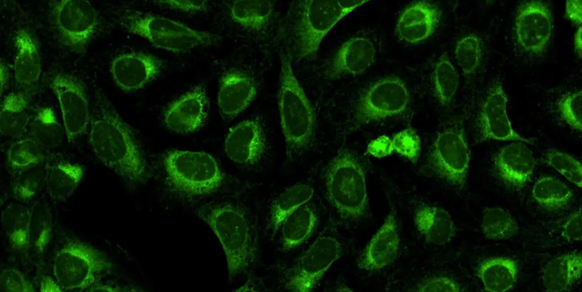 Endoplasmic reticulum -Dye: Concanavalin A/Alexa Fluor 488 conjugate