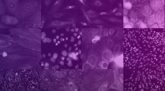 Recursion produce the largest publicly available set of human cellular morphological data for COVID-19 therapeutic research