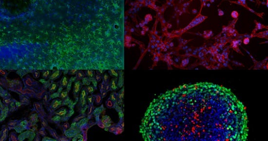 Tips for Molecular Cloning & Strain Engineering Efficiency | Molecular Devices