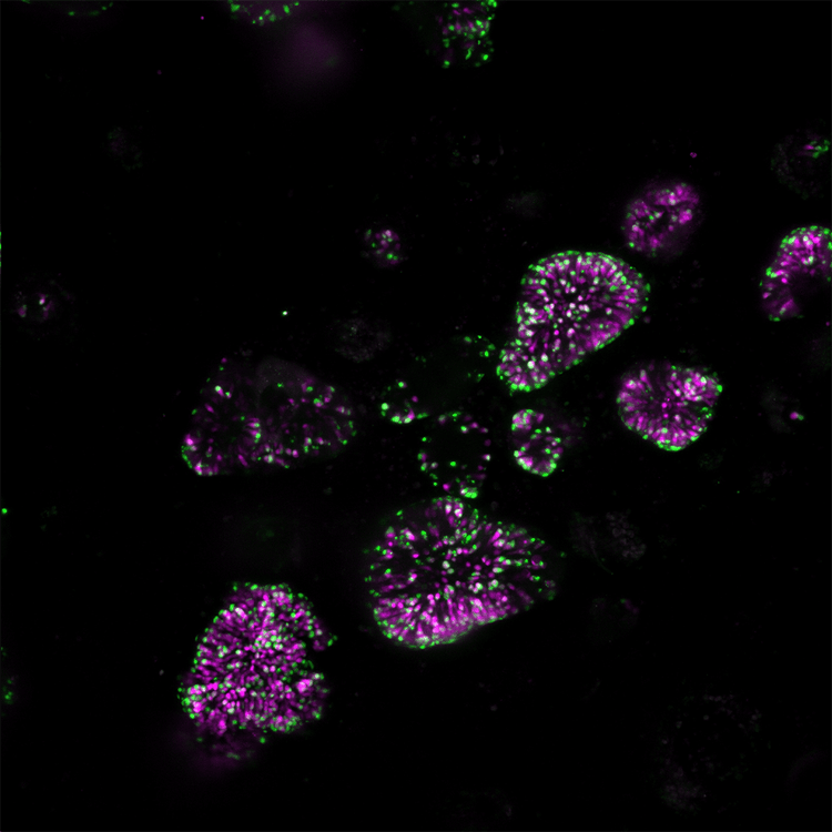 Internally expressed genes dTomato magenta mNeon green 10x