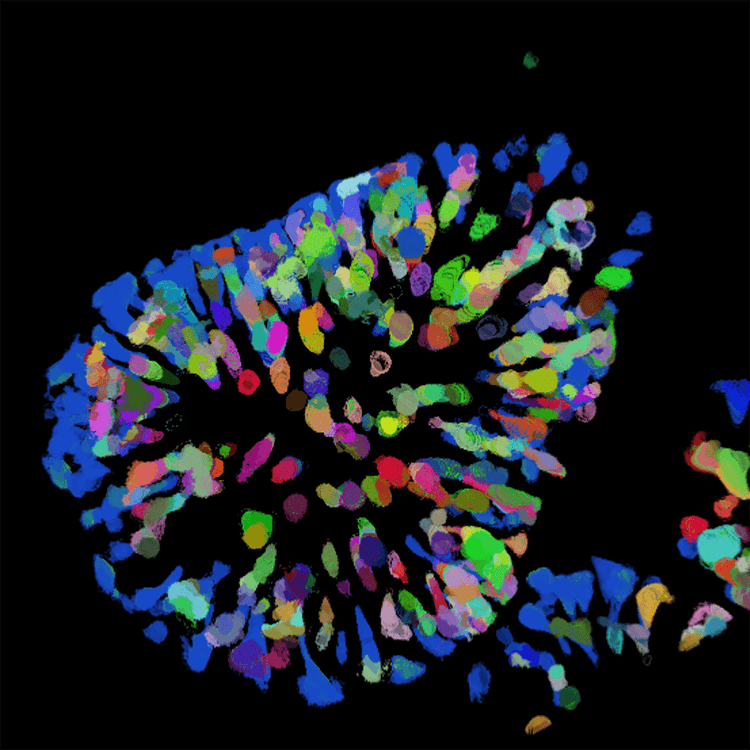 Intestinal organoid 40x,dTomato cell count