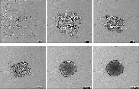 Workflow for testing spheroids in a high-throughput screening environment. A single spheroid can be grown in a 96- or 384-well plate, treated with compound, and stained with a cocktail of dyes that can be imaged without washing