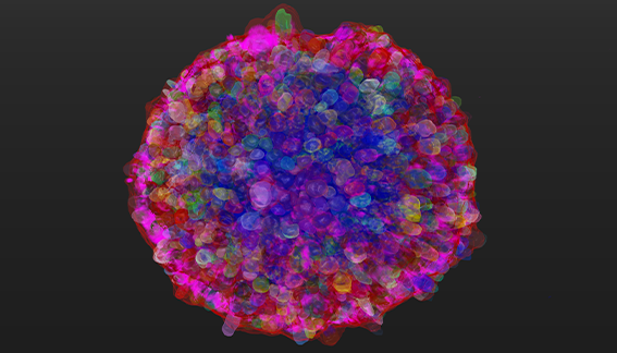 Transforming High-Content Screening with Intelligent Imaging & AI Analysis