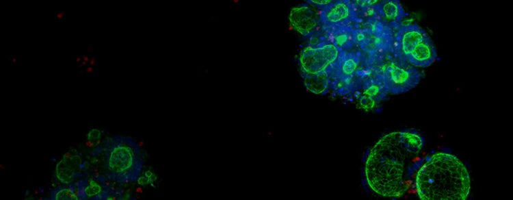 Organoid Models