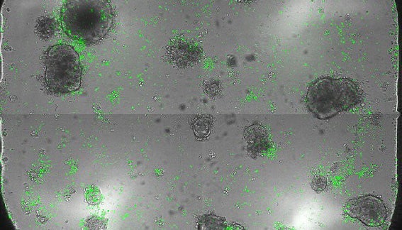 Novel Workflow to Quantify Interaction between T-Cell and Patient-Derived Organoids