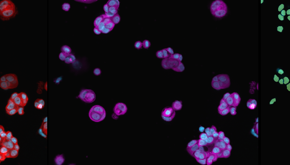 High-speed Phenotypic Profiling using Imaging with AI Image Analysis