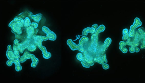 Evaluating compound toxicity effects on healthy intestinal organoids using high-content imaging