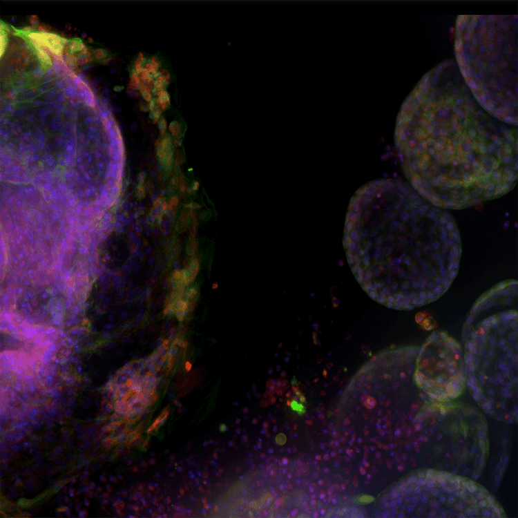 DNA damage overlay in U2OS cells