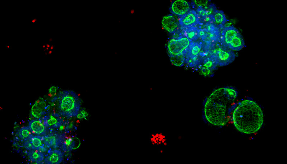 Organoid Models