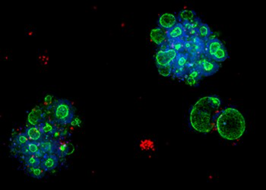 Organoid Models