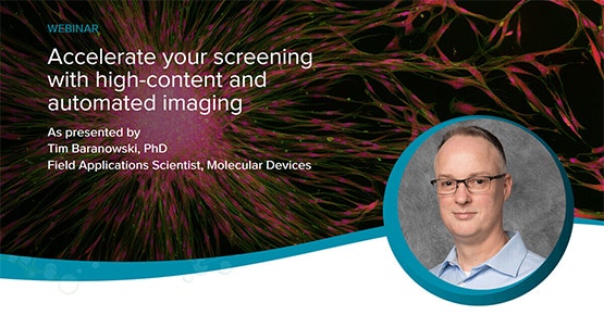 Accelerate your screening with high-content and automated imaging