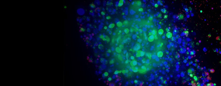Disease Modeling