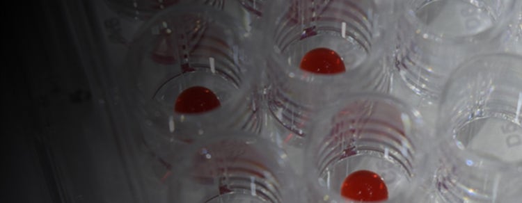 3D Bioprinting
