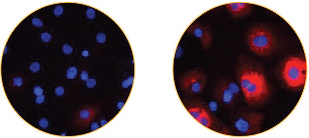 BNP expression in iCell Cardiomyocytes before and after ET-1 addition